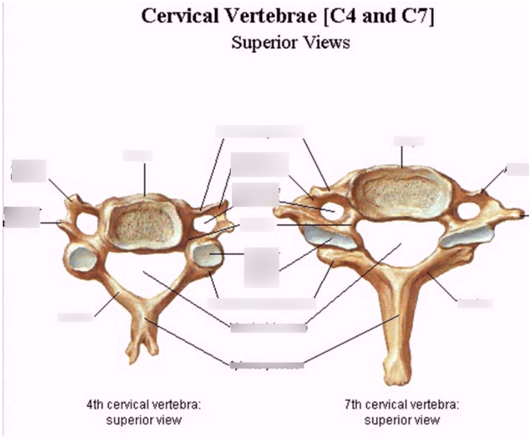 <p>These diagrams show C4 and C7 but really work for C3-C7. According to LAB TA you only need to know the  names of C1 and C2 (atlas and axis, respectfully). Most terms (but not all are included from the wish list because I would have to find a new vertebre and I really don’t want to)</p>