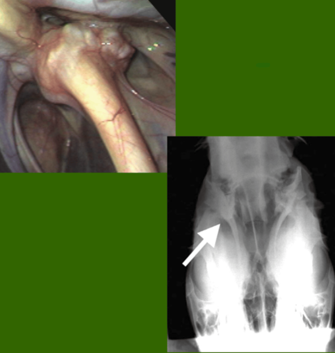 <p>Identify the pathology?</p>