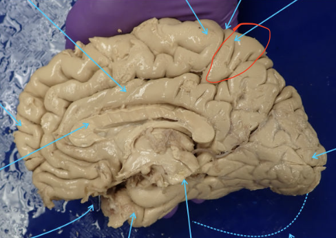 <p>Location of the primary somatosensory cortex</p>