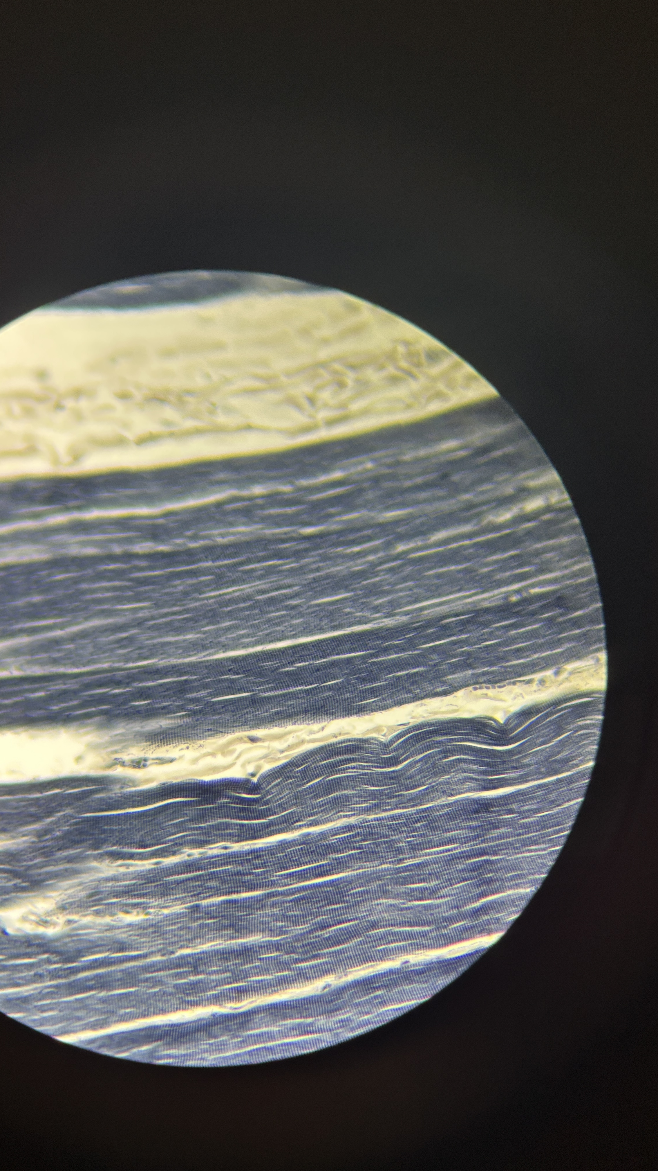 <p>What is the magnification level of the Skeletal Muscle?</p>