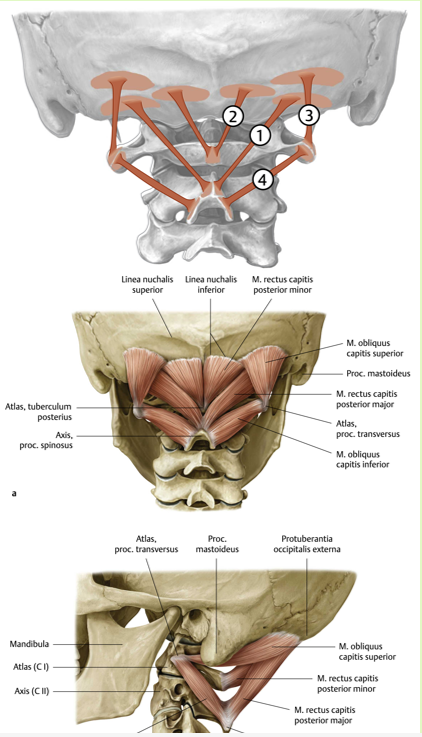 <p><span><span> Origo:<br></span></span><span data-name="black_small_square" data-type="emoji">▪</span><span><span> tuberculum posterius van CI (Atlas)</span></span></p><p><span><span><br></span></span><span data-name="black_small_square" data-type="emoji">▪</span><span><span> Insertie:<br></span></span><span data-name="black_small_square" data-type="emoji">▪</span><span><span> mediale 1/3 deel van linea nuchalis<br>inferior</span></span></p><p><span><span><br></span></span><span data-name="black_small_square" data-type="emoji">▪</span><span><span> Functie:<br></span></span><span data-name="black_small_square" data-type="emoji">▪</span><span><span> extensie, homolaterale rotatie</span></span></p><p><span><span><br></span></span><span data-name="black_small_square" data-type="emoji">▪</span><span><span> Innervatie:<br></span></span><span data-name="black_small_square" data-type="emoji">▪</span><span><span> r. dorsalis van C1 (n. suboccipitalis)</span></span></p><p><br></p>