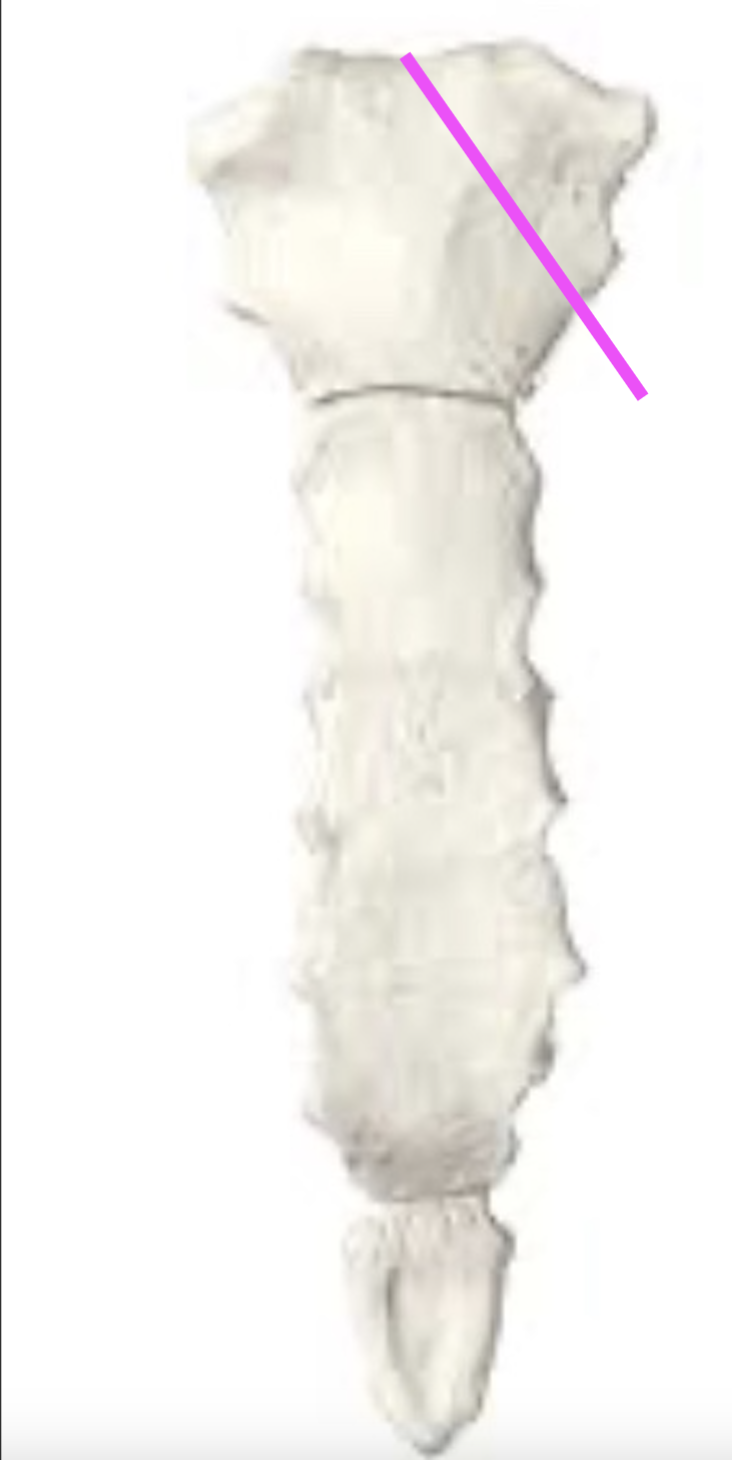 <p>what part of the sternum is this?</p>