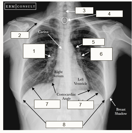 <p>Identify the structures on the X-RAY </p>