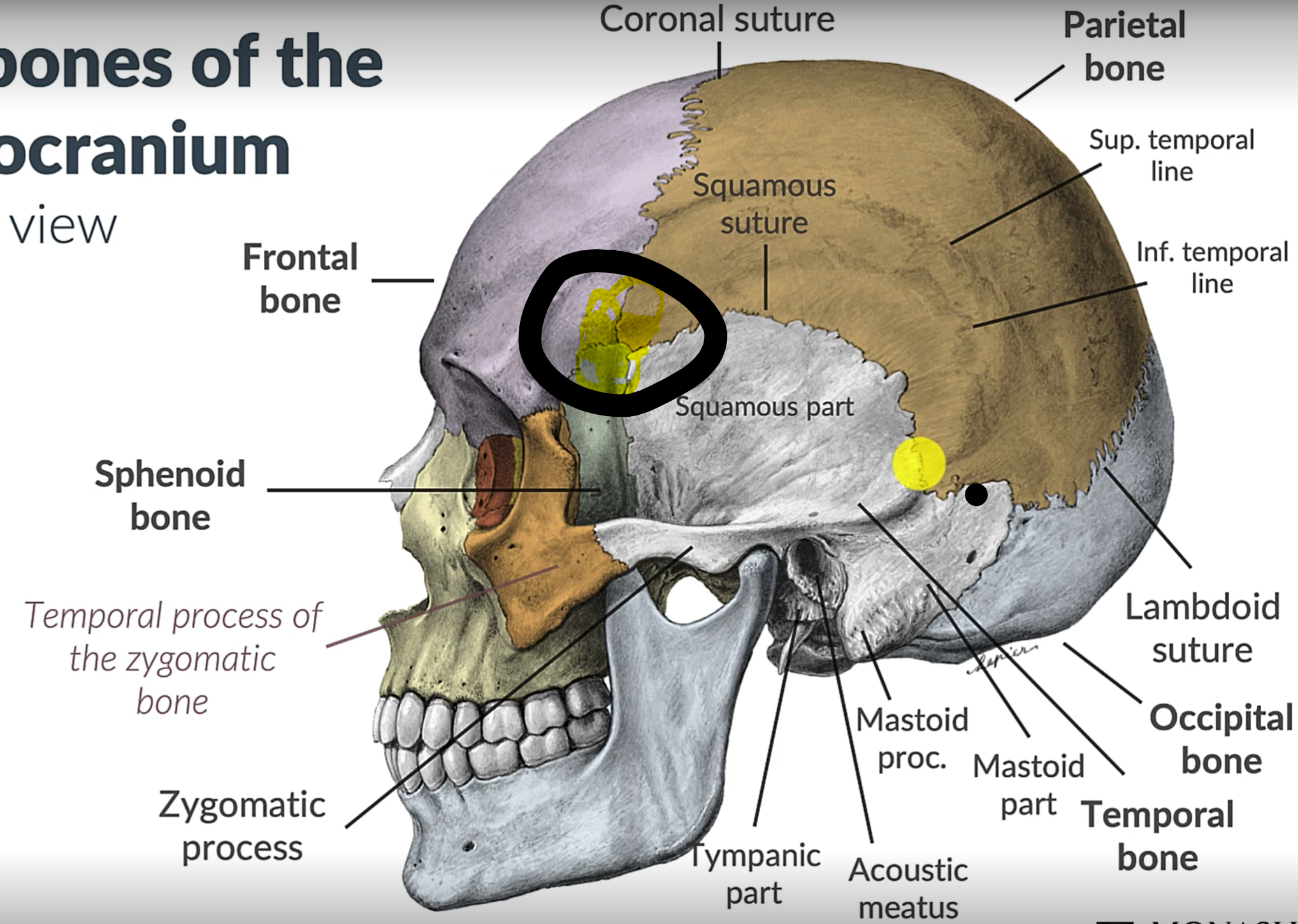 term image
