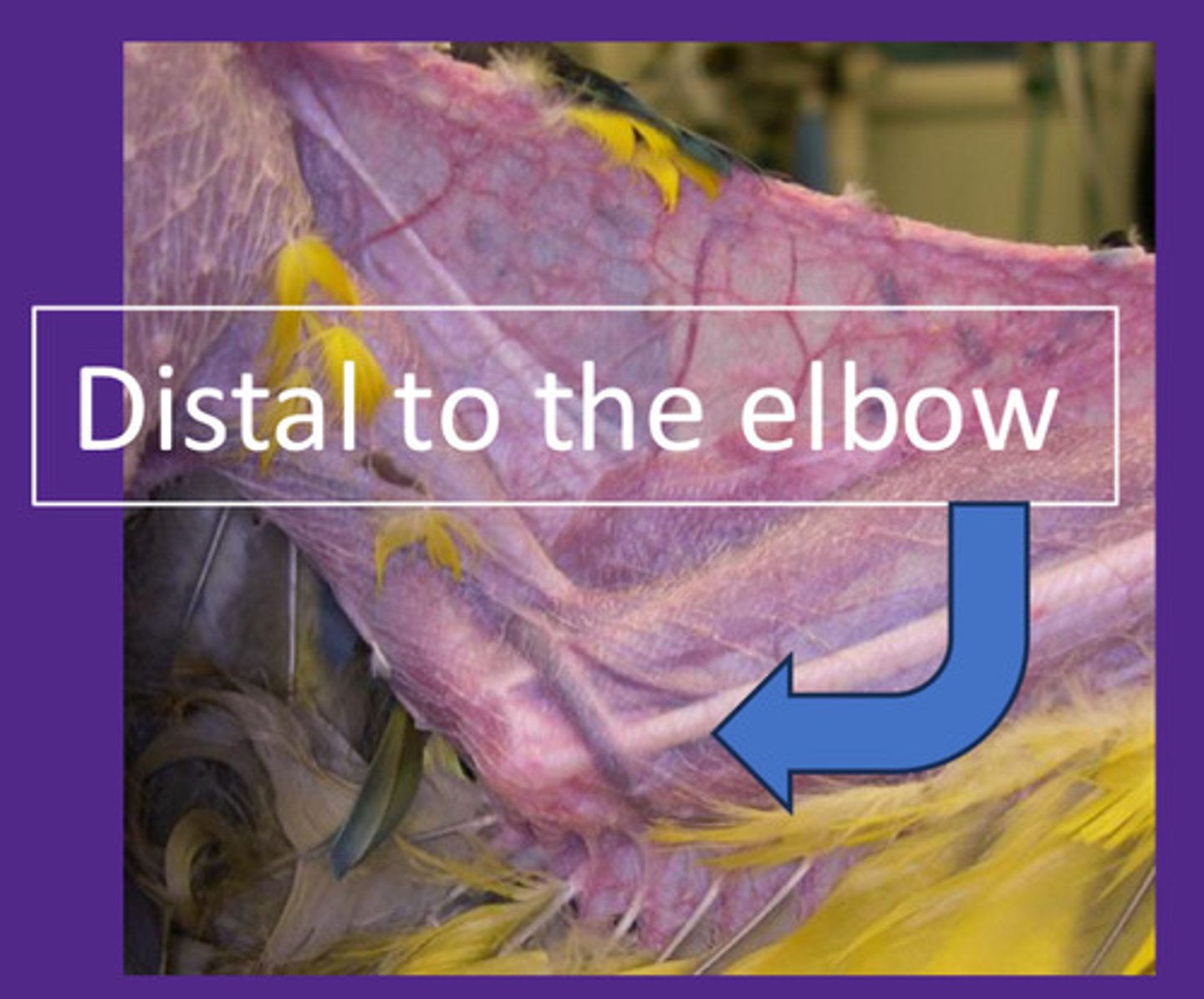 <p>What does the ulnar vein reill time indicate? When is it considered normal and abnormal?</p>