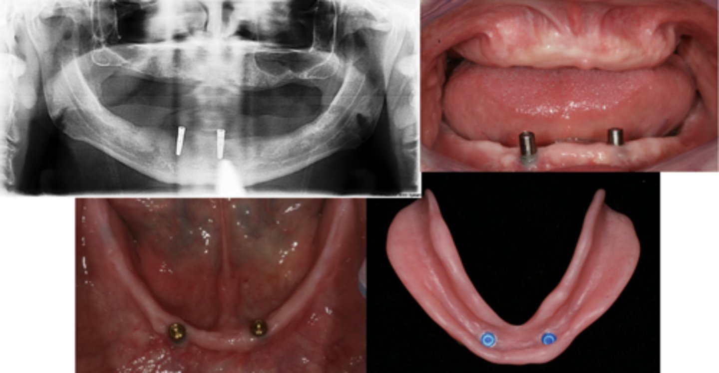 <p>What are these images showing?</p>