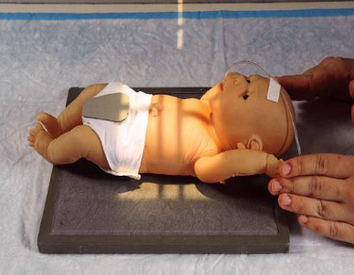 <ul><li><p>infant is supine</p></li><li><p>move arms out of anatomy of interest</p></li><li><p>bring legs down</p></li><li><p>leave head rotated to avoid advancing endotracheal tube too far</p></li><li><p>collimate closely</p></li><li><p>shield gonads</p></li><li><p>CR is perpendicular to IR</p></li><li><p>infant respirations are rapid</p></li></ul><p></p>