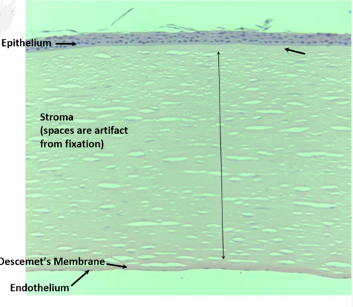 <p>-Anterior epithelium<br>-Bowman's Layer<br>-Stroma<br>-Descemet's Membrane<br>-Endothelium</p>