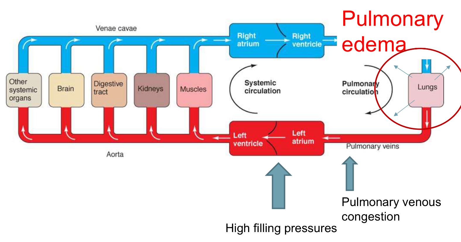 <ul><li><p>pulmonary edema</p></li><li><p>pulmonary venous distention</p></li></ul><p></p>