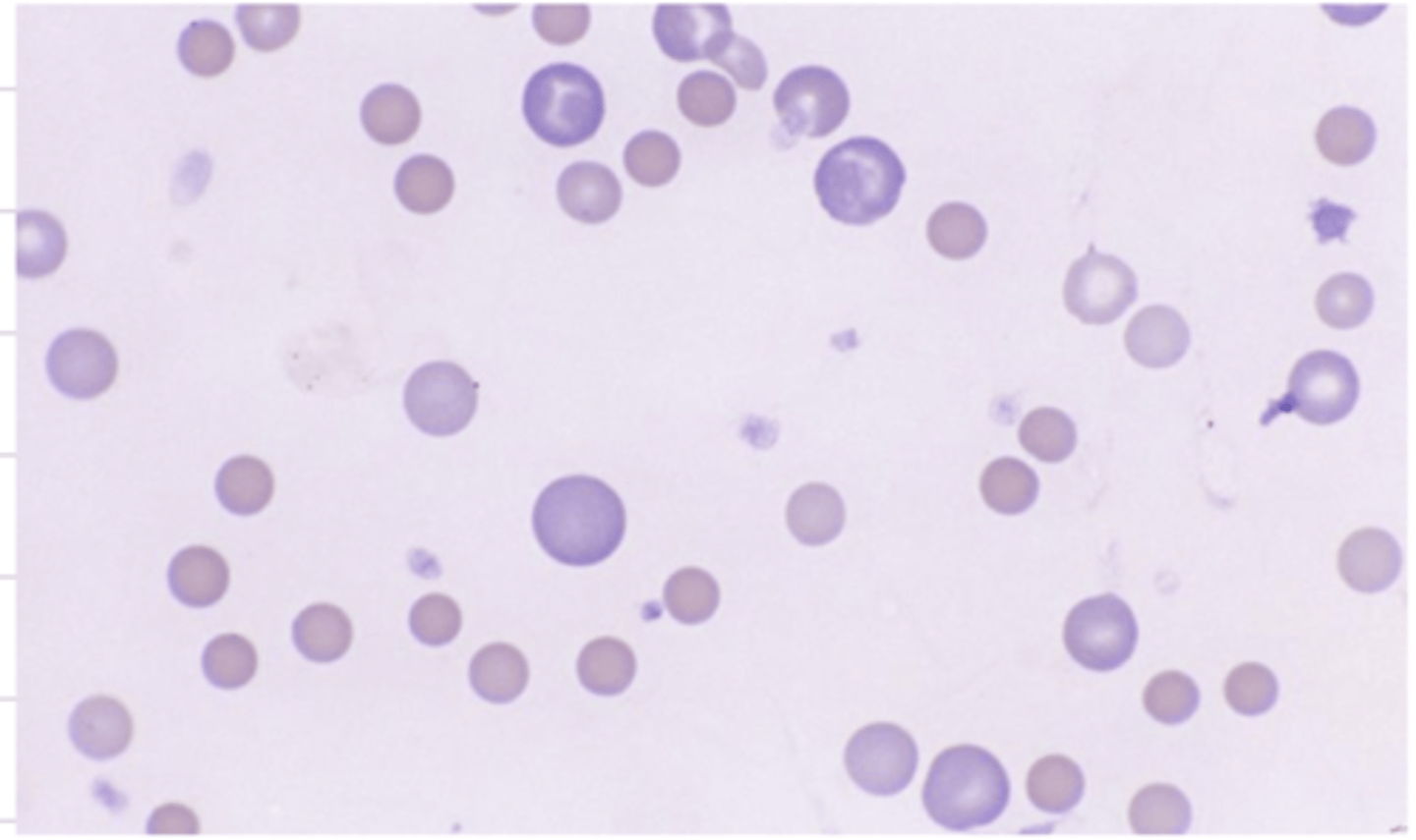 <p>is this anemia regenerative or non regenerative? why?</p>