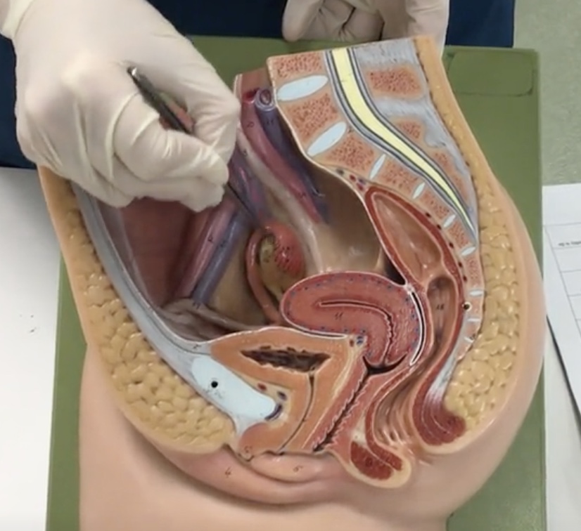 <p>Description: Funnel shaped opening of utuerine tube with fimbriae</p><p>Relationship: N/A</p>