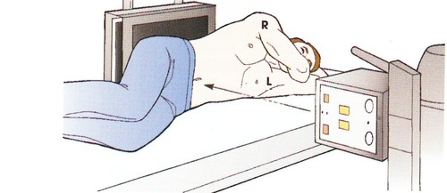 <p>refers to a lateral projection that is exposed using a horizontal beam technique</p>