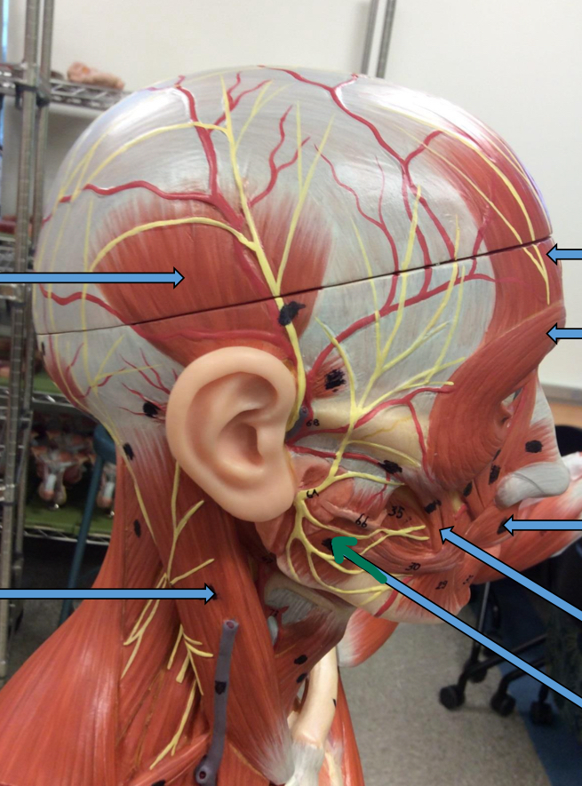 <p>Identify this muscle?</p>