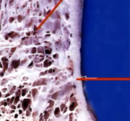 <p>identify the different types of bone</p>