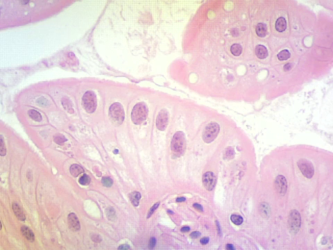 <p>what kind of tissue is this?</p>