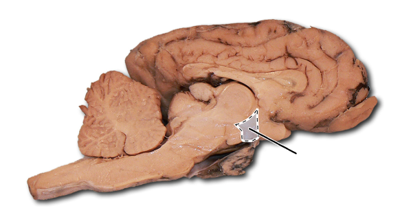 <p>Name the part of the brain that is highlighted.</p>