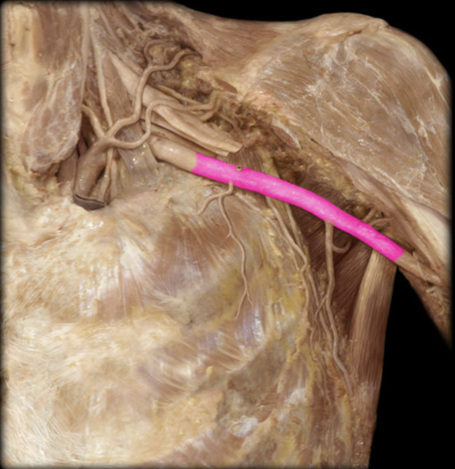 <p><em>table 7, crosses through brachial plexus</em></p>