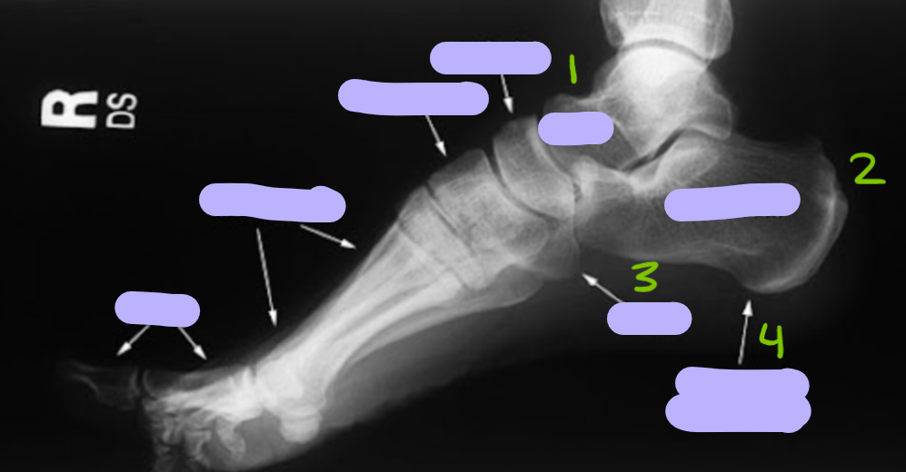 <p>identify these bones and bony landmarks</p>