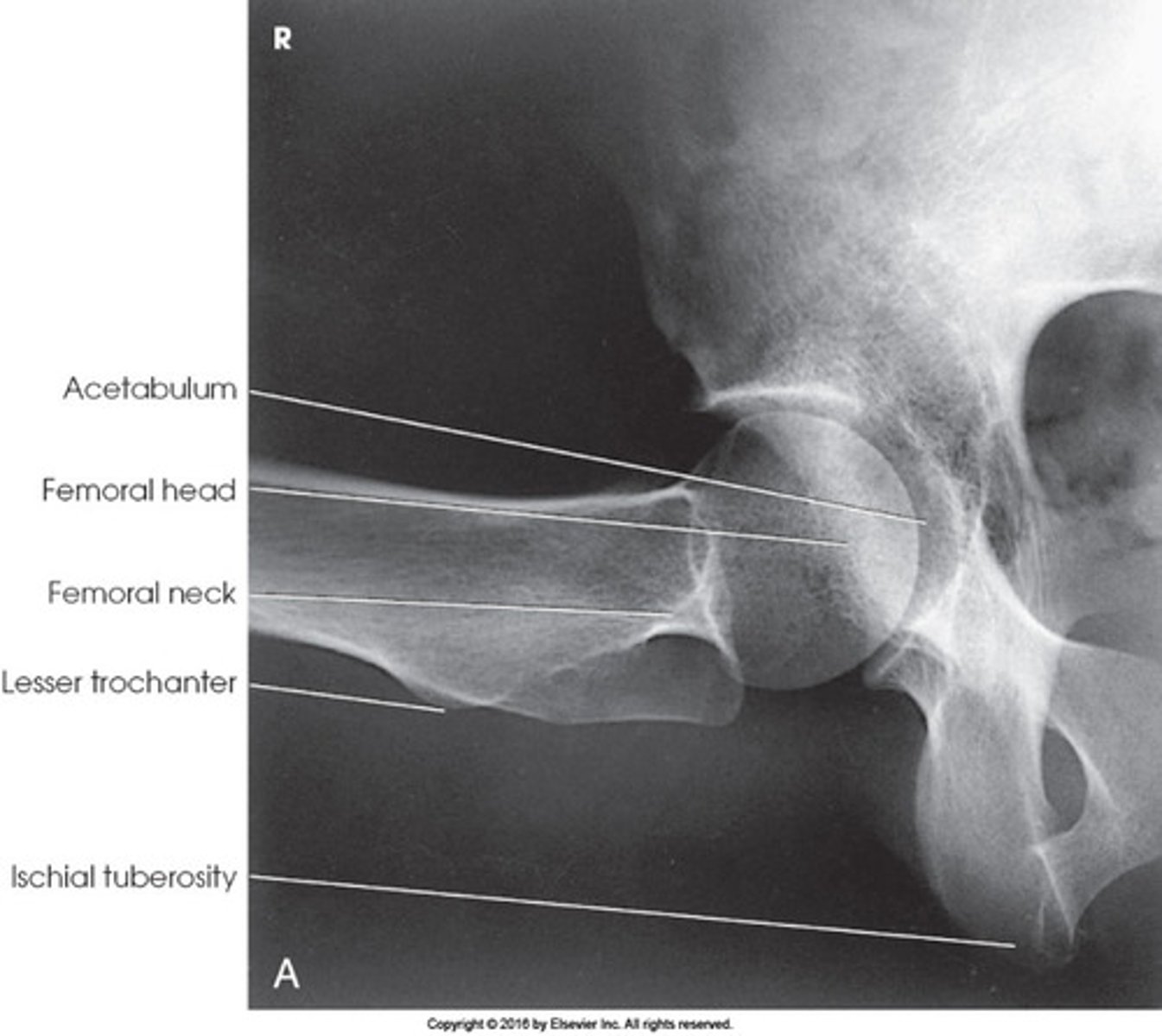<p>Identify the projection:</p><p>AP Hip</p><p>Axiolateral Hip (Danelius-Miller)</p><p>AP oblique hip (Modified Cleaves)</p><p>Lateral hip (Lauenstein)</p>
