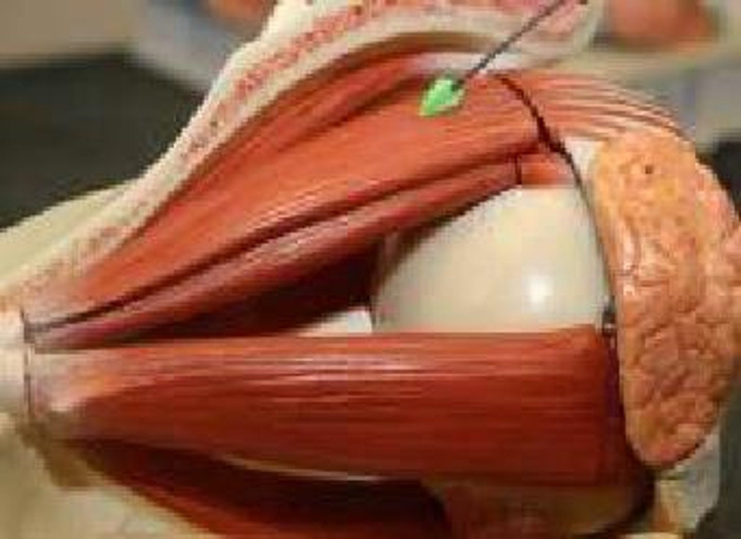 <p>elevates upper eyelid</p>