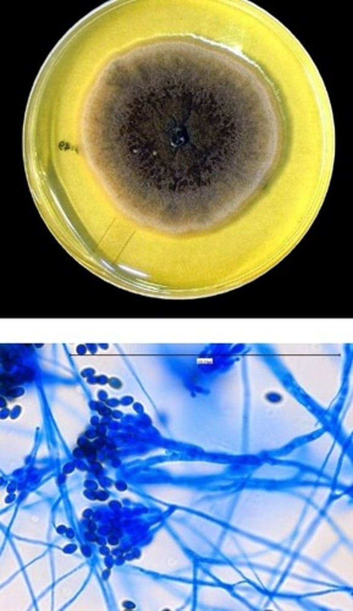 <p>• Contaminants but can cause</p><p>infection</p><p>• Powdery brown/tan colonies</p><p>• Rough "lemon drop" conidia</p>