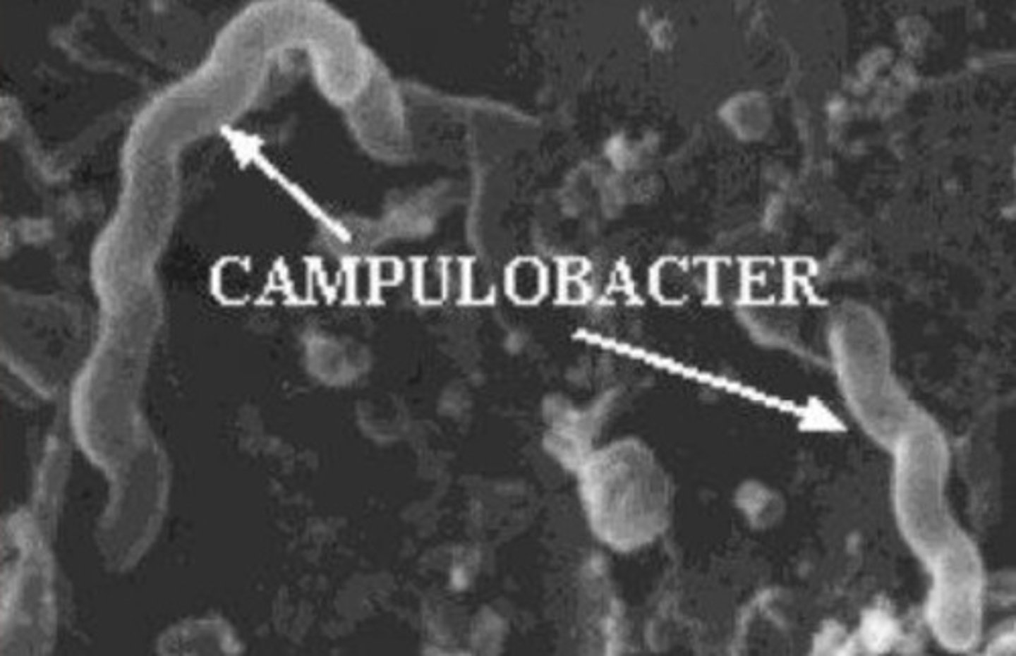<p>Spirochetes</p>