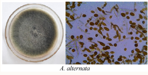 <ul><li><p><span><span>Wool surface with short aerial mycelia</span></span></p></li><li><p><span><span>Greyish-greenish-sometimes black</span></span></p></li><li><p><span><span>Light border</span></span></p></li><li><p><span><span>Reverse is black</span></span></p></li><li><p><span><span>Mature in 5 days</span></span></p></li></ul><p></p>