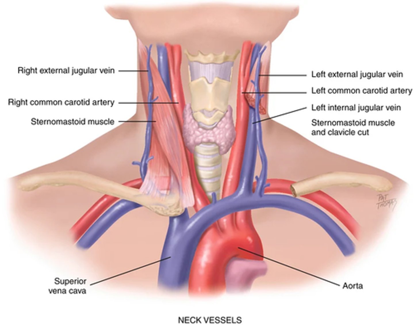 <p>- A pressure wave generated by each systole pumping blood into the aorta.</p><p>Carotid artery = central artery</p><p>(Its timing closely coincides with ventricular systole)</p><p>Carotid artery -> located in the groove between the trachea and the sternomastoid muscle, medial to and alongside that muscle.</p><p>Characteristic of the wave form -> a smooth rapid upstroke, a summit that is rounded and smooth, and a downstroke that is more gradual and has a dicrotic notch caused by closure of the aortic valve (signified by d in the next flashcard image)</p>