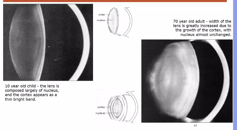 <p>growth of lens </p>