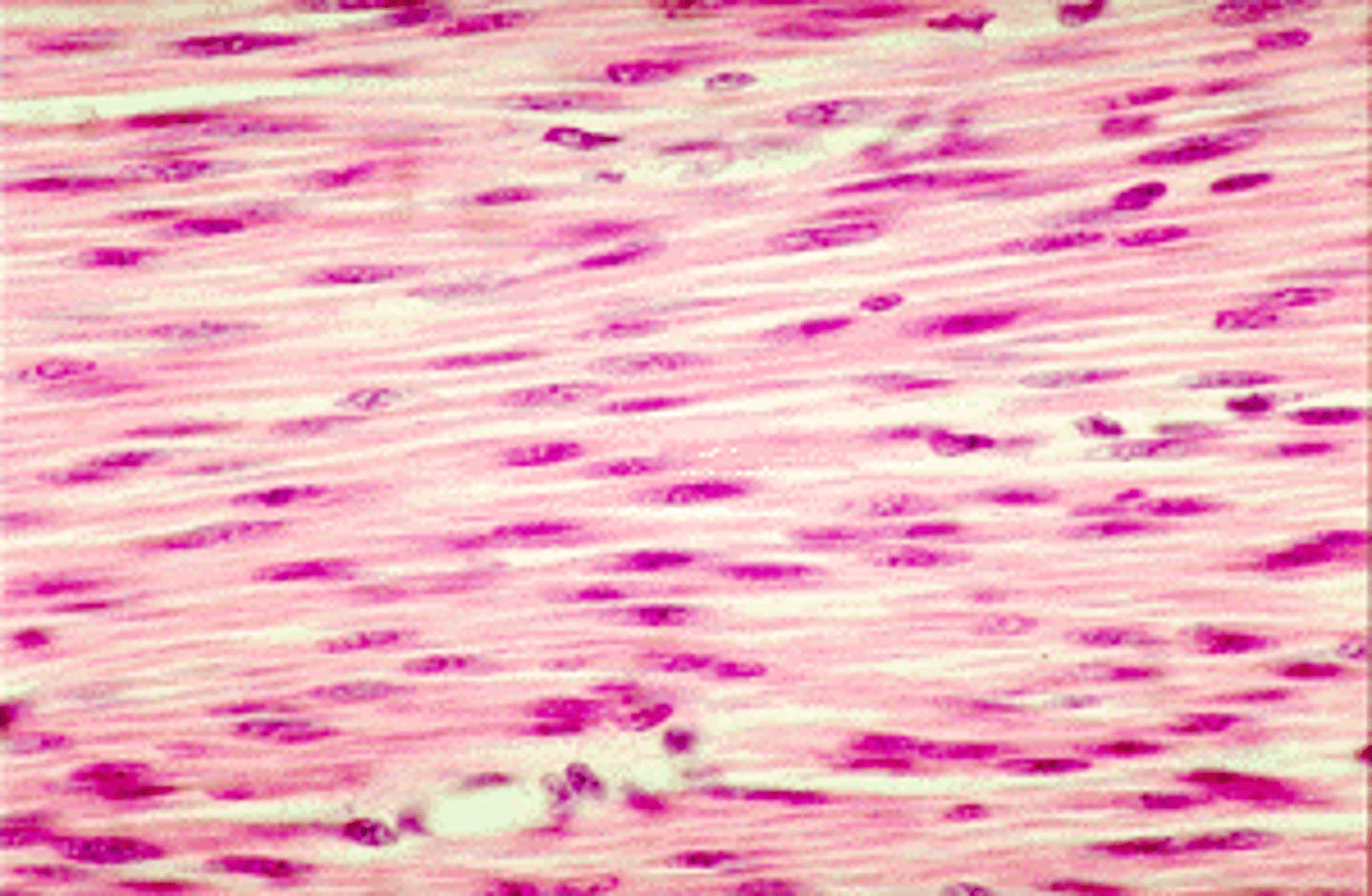 <p>example: hollow organs (uterus, stomach)</p><p>function: involuntary movement of substances</p>
