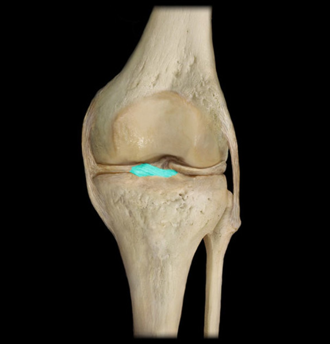 <p>-lower extremity (knee, crus, ankle)</p>