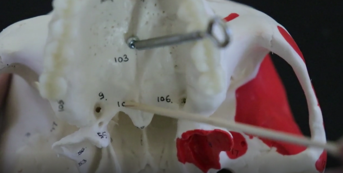 NOT THE Palatine Process of the Maxilla (don’t get that confused)