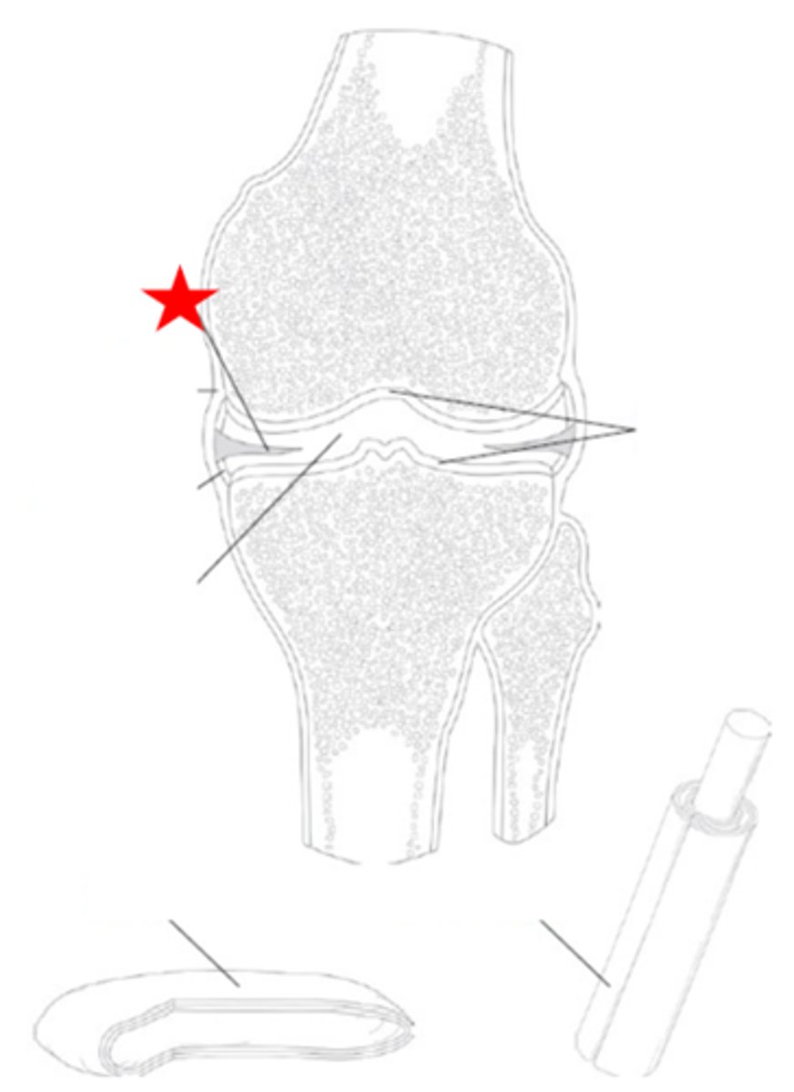 <p>Identify the synovial joint structure that the star is pointing to.</p>