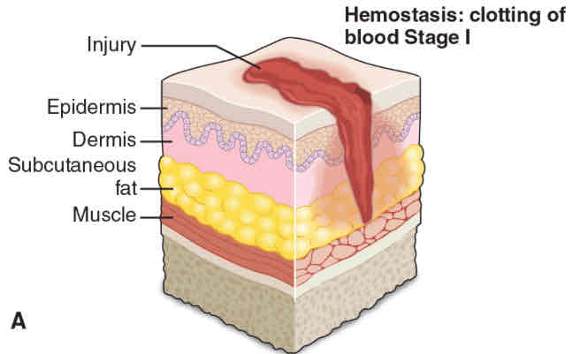 <p>Exposed collagen of injury</p><ul><li><p>Attracts platelets</p></li></ul><p>Platelets aggregate</p><ul><li><p>To secrete inflammatory mediators</p></li></ul><p>Vasoactive amines</p><ul><li><p>Cause short-term vasoconstriction</p></li></ul><p></p>