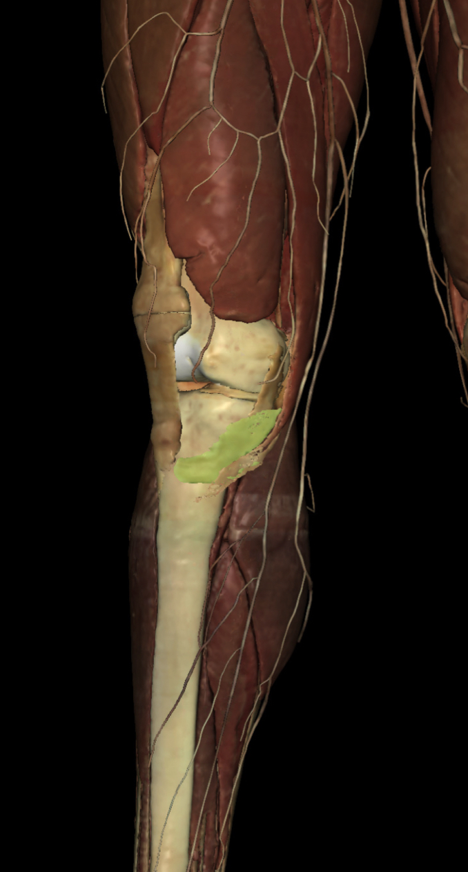 <p>Identify the Structure</p>