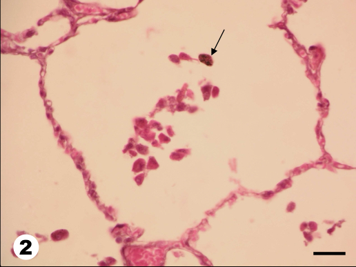 <p>Seta-</p>