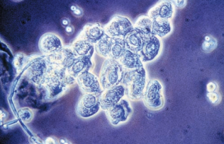 RTE cells under phase microscopy