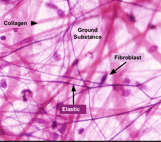 <p>contains, <strong>collagen, elastic fibers, </strong>and <strong>fibroblasts </strong></p><p>helps bind other tissues together and part of inflammatory response</p><p>part of SKIN and MUSCLE&nbsp;</p>