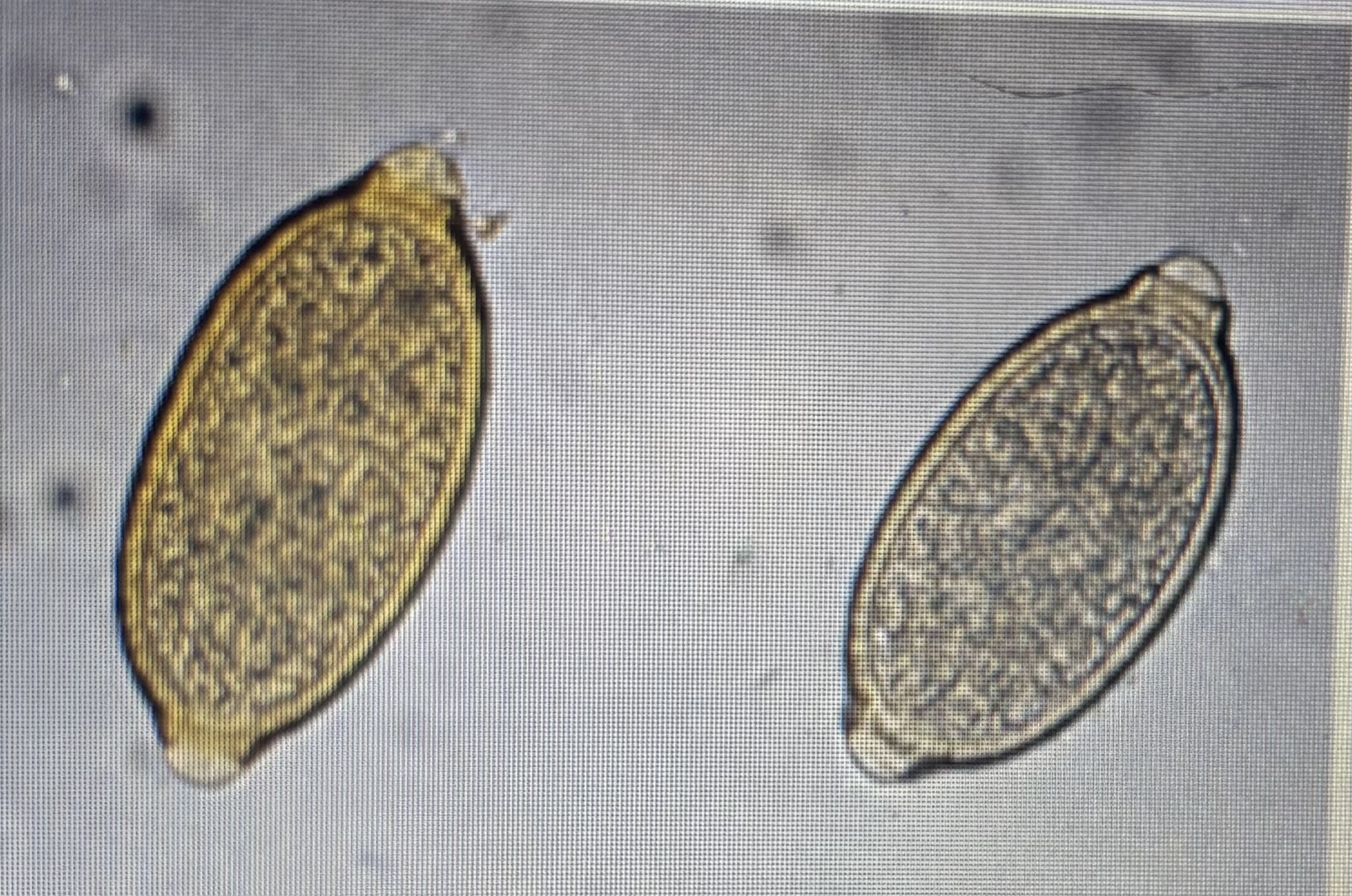 <p>Trichurid - eucoleous</p><p>Host species: dogs</p><p>Size: 54-60 um x 30-35 um</p><p>Prepatent period: 42 days</p><p>Transmission: ingestion</p><p>symmetrical polar plugs</p>
