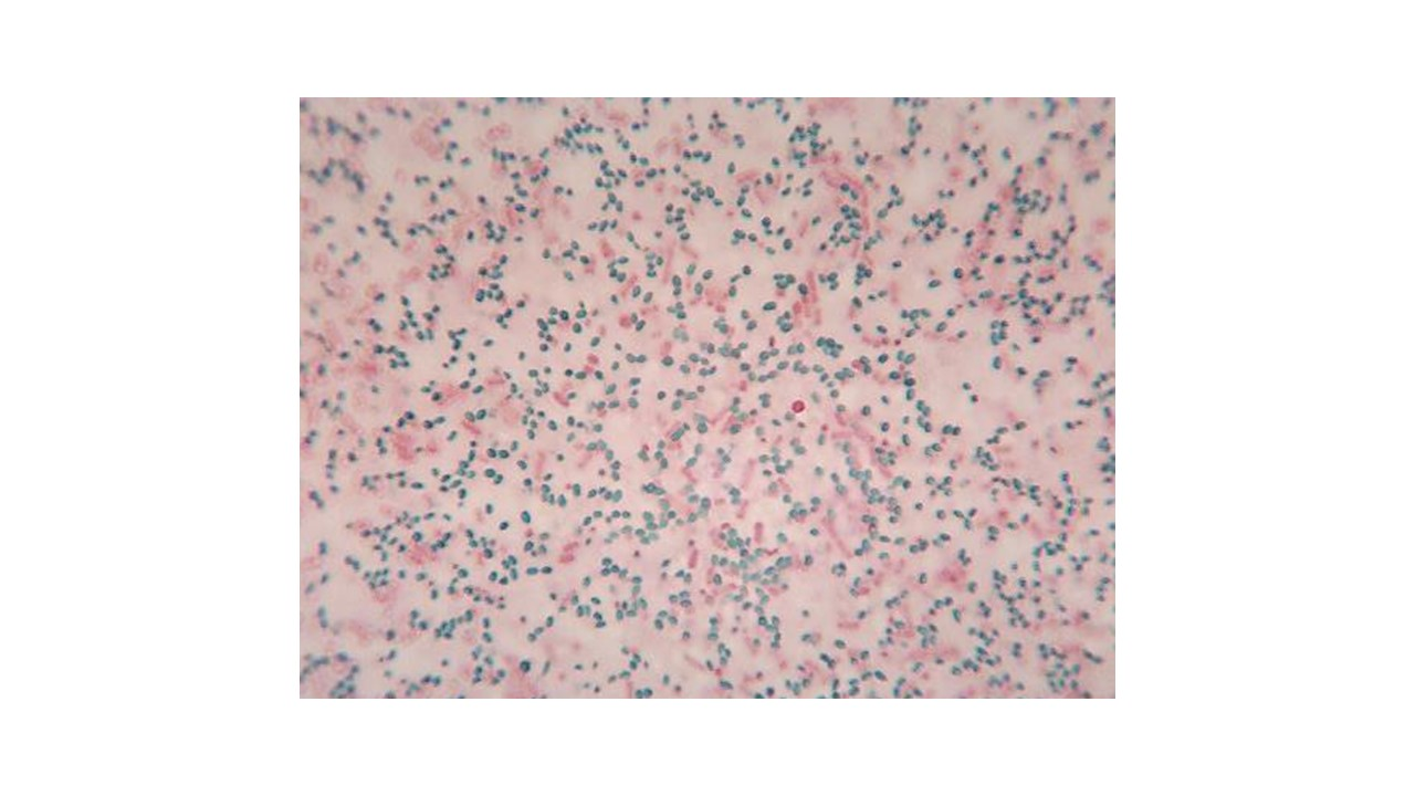 <p>l<span>ooking at the micrograph, does the bacteria Bacillus megaterium produce spores</span></p>