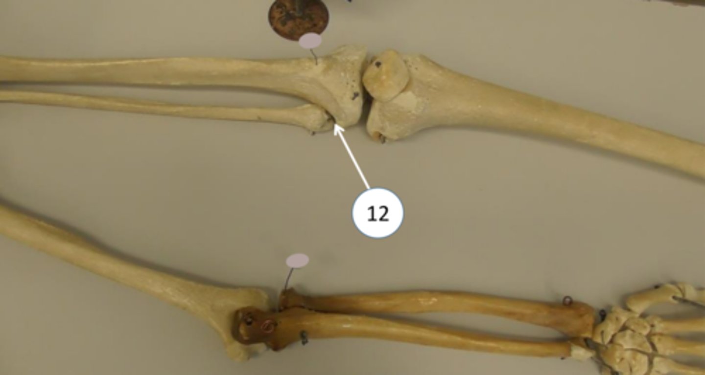 <p>Articulation between the tibia and the fibula in the leg</p>