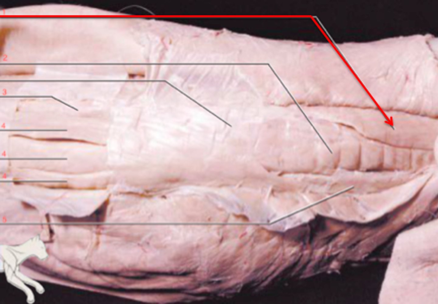 <p>Action: extends vertebral column</p>
