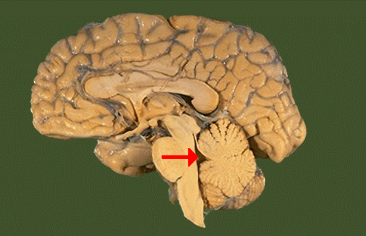 <p>Label this brain part</p>