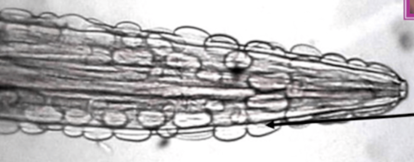 <p>which parasite has these anterior cuticular plates?</p>