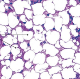 <p>adipose (connective)</p>