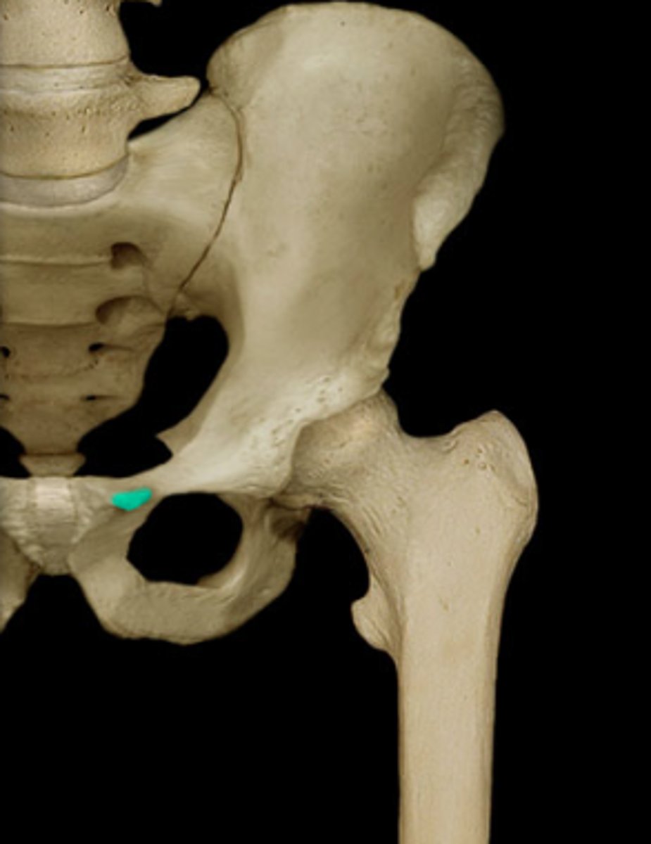 <p>lateral end of the pubic crest; lateral attachment for the inguinal ligament</p>