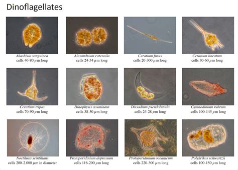 <p>What are Dinoflagellates&nbsp;</p>
