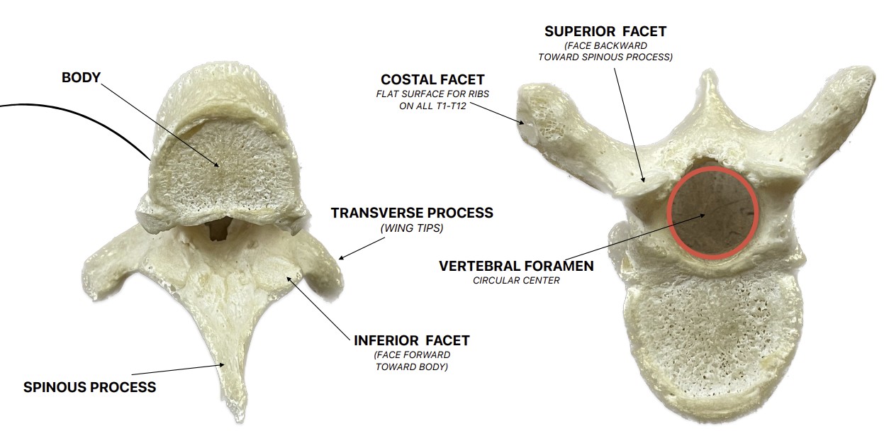 <p>What are these landmarks of:</p><ul><li><p>Transverse process - wing tip</p></li><li><p>Vertebral body - main body</p></li><li><p>Spinous process - long tip, points downward</p></li><li><p>Lamina - connect SP to wings (lay on back)</p></li><li><p>Pedicle - connect body to wings (p in front)</p></li><li><p>Vertebral foramen - circular center</p></li><li><p>Superior facet - face backward toward spinous process</p></li><li><p>Inferior facet - face forward toward body</p></li><li><p><span style="color: yellow;"><strong>Costal facet - flat surface for ribs</strong></span></p></li></ul><p></p>