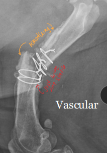 <p><span style="background-color: transparent;"><strong>Complications of Bone Healing</strong></span></p>