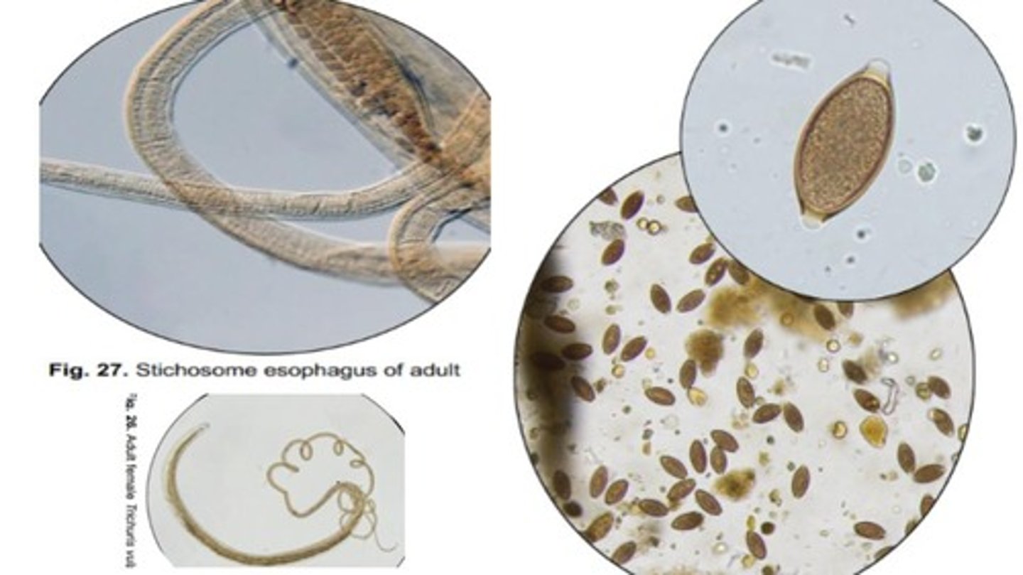 <p>Whipworms that infect the cecum & colon of domestic/wild canids</p><p>-Adults have a long stichosome esophagus composed of stichocytes</p><p>-Eggs are football-shaped with bipolar plugs & a smooth surface</p>